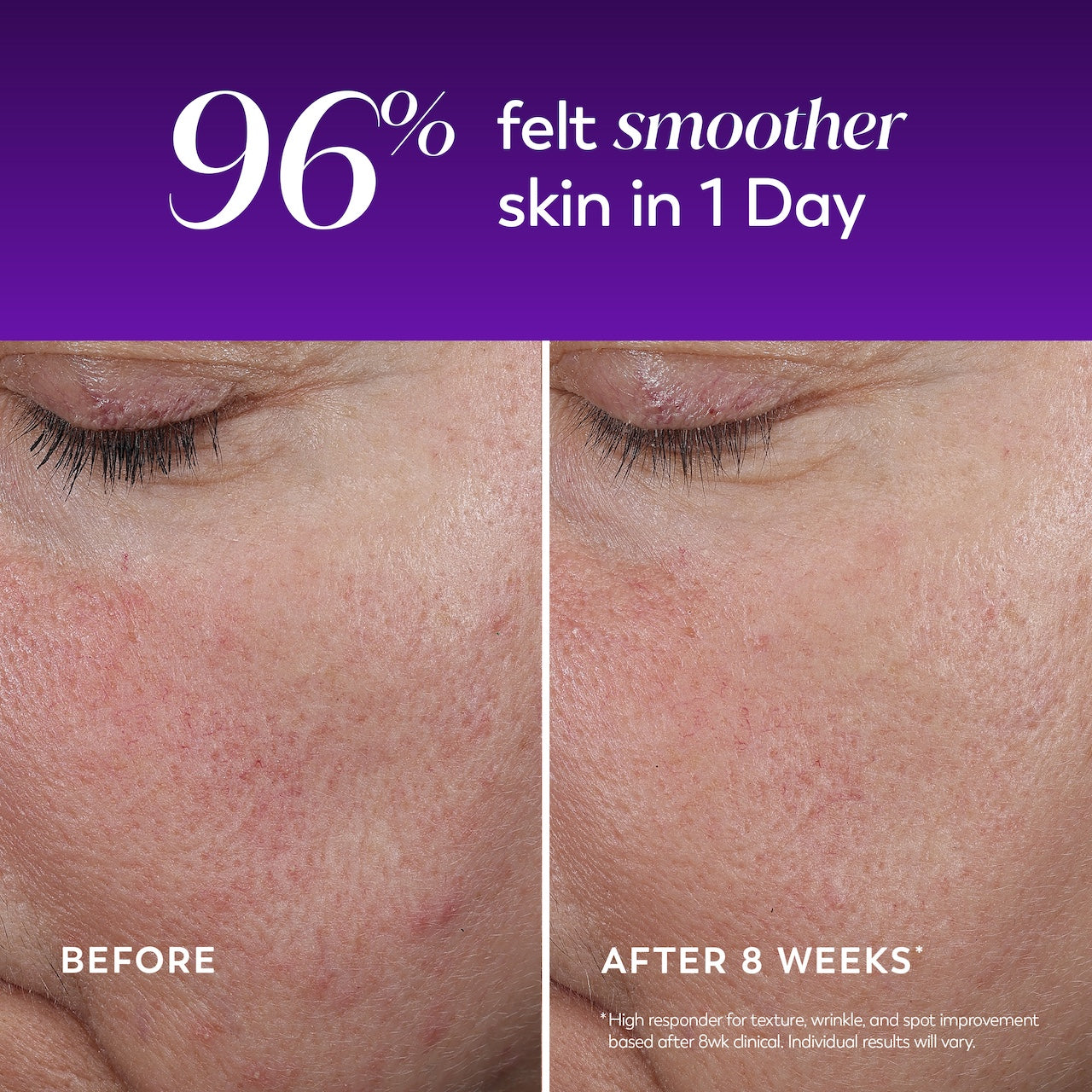 Olay / Regenerist Wrinkle Correcting Night · Fragrance-Free Care