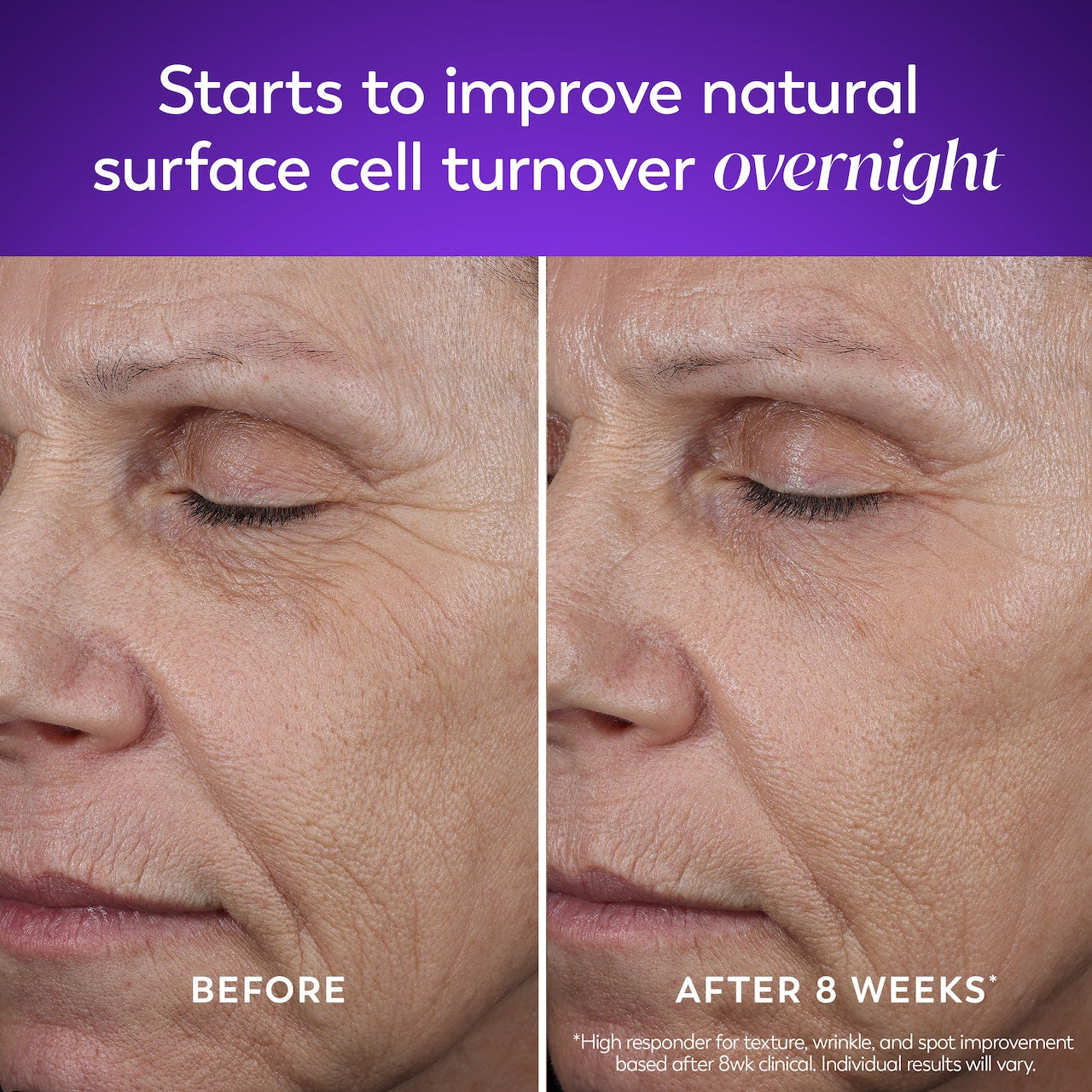Olay Retinol MAX Night · Overnight Renewal