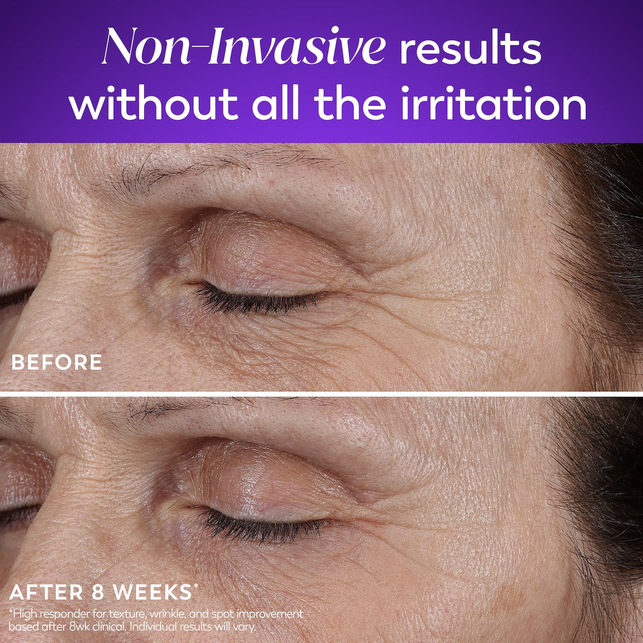 Olay Retinol MAX Night · Overnight Renewal